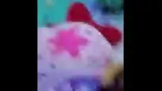 تشغيل عظام الخد