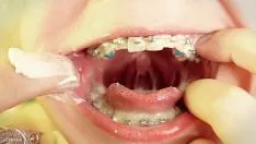 Riproduci Nutrire con il tutore - bloccare la registrazione video - cibo solido feticcio - verbalizzare l'incantesimo